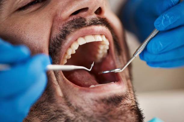 Best After-Hours Emergency Dentist in Bluffton, IN